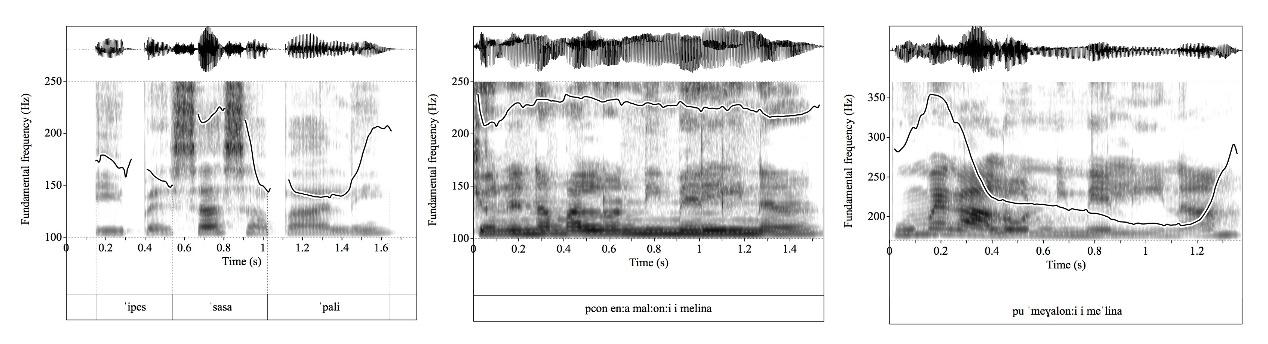 Voice wave graphs