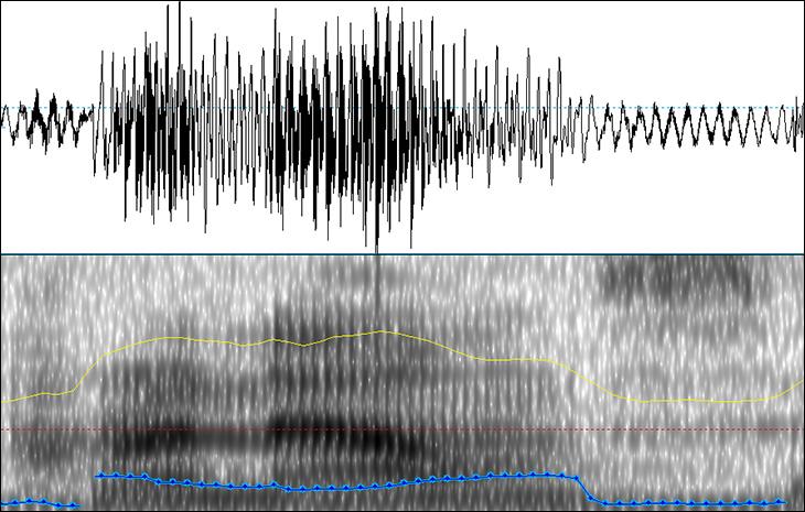 Voice waveform